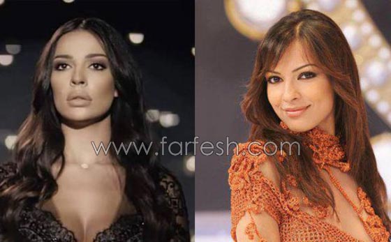 صور الفنانات قبل وبعد عمليات تجميل تكبير الشفاه صورة رقم 6 صور الفنانات قبل وبعد عمليات تجميل تكبير الشفاه صورة رقم 6