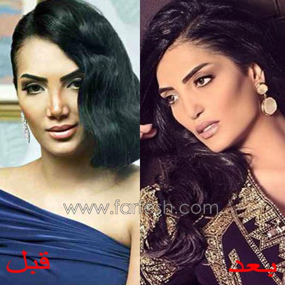 حورية فرغلي: انا ملكة جمال شابة ولا أحتاج عملية تجميل! صورة رقم 1 حورية فرغلي: انا ملكة جمال شابة ولا أحتاج عملية تجميل! صورة رقم 1