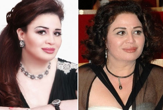 صور النجوم قبل وبعد الـ (فوتوشوب): لن تصدق التغيير! صورة رقم 7 صور النجوم قبل وبعد الـ (فوتوشوب): لن تصدق التغيير! صورة رقم 7