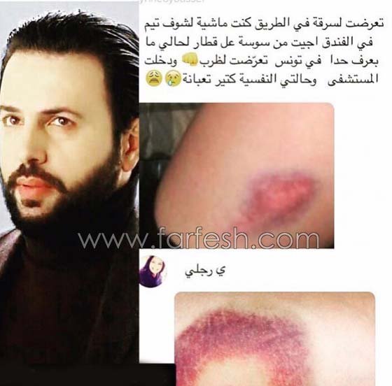 صور: بلطجية يعتدون على فتاة تونسية بالضرب بسبب تيم حسن! صورة رقم 1 صور: بلطجية يعتدون على فتاة تونسية بالضرب بسبب تيم حسن! صورة رقم 1