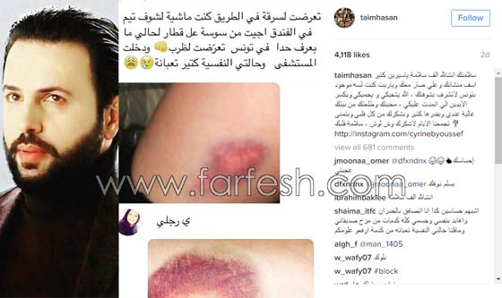 صور: بلطجية يعتدون على فتاة تونسية بالضرب بسبب تيم حسن! صورة رقم 2 صور: بلطجية يعتدون على فتاة تونسية بالضرب بسبب تيم حسن! صورة رقم 2
