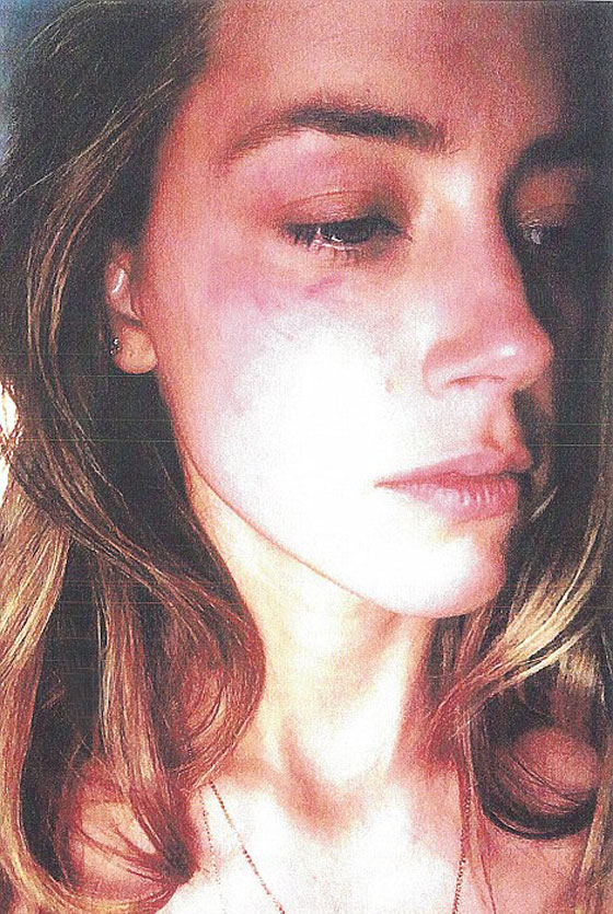  النجم جوني ديب ممنوع من الاقتراب من زوجته بعد تعنيفها صورة رقم 22