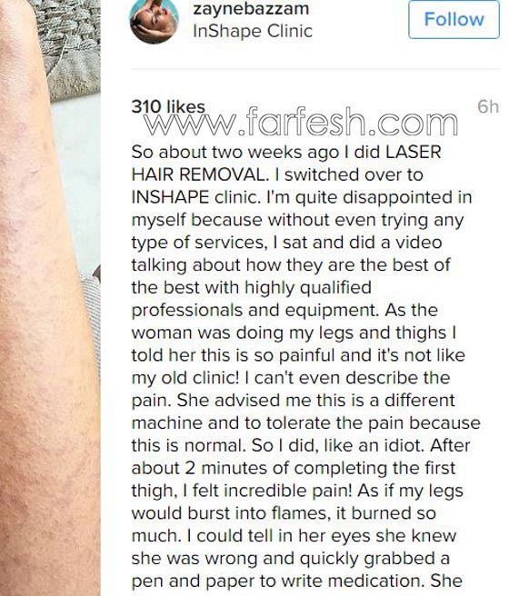 صور صادمة: عارضة أزياء مصرية تفضح عيادة لإزالة الشعر بالليزر صورة رقم 2 صور صادمة: عارضة أزياء مصرية تفضح عيادة لإزالة الشعر بالليزر صورة رقم 2