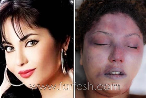 صور جريمة ذبح الفنّانة السورية شيندا خليل على يد شقيقها! صورة رقم 1 صور جريمة ذبح الفنّانة السورية شيندا خليل على يد شقيقها! صورة رقم 1
