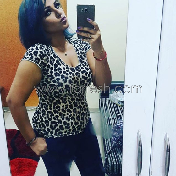 فيديو فنانة كويتية شهيرة تفضح زوجها بعد ان ضربها ضرباً مبرحاً صورة رقم 3