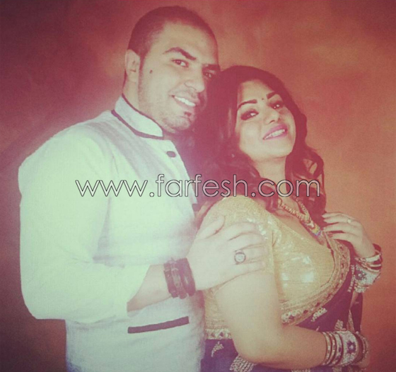 فيديو فنانة كويتية شهيرة تفضح زوجها بعد ان ضربها ضرباً مبرحاً صورة رقم 2