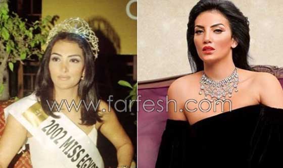 صور فنانات اجرين عمليات تجميل فاشلة نجم عنها التشويه الشلل والوفاة صورة رقم 6 صور فنانات اجرين عمليات تجميل فاشلة نجم عنها التشويه الشلل والوفاة صورة رقم 6