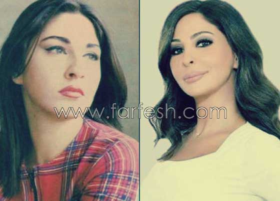 صور فنانات اجرين عمليات تجميل فاشلة نجم عنها التشويه الشلل والوفاة صورة رقم 14 صور فنانات اجرين عمليات تجميل فاشلة نجم عنها التشويه الشلل والوفاة صورة رقم 14