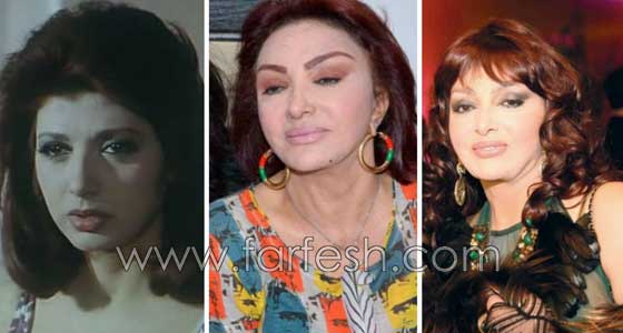 صور فنانات اجرين عمليات تجميل فاشلة نجم عنها التشويه الشلل والوفاة صورة رقم 4 صور فنانات اجرين عمليات تجميل فاشلة نجم عنها التشويه الشلل والوفاة صورة رقم 4