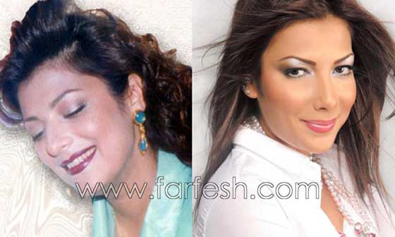 صور فنانات اجرين عمليات تجميل فاشلة نجم عنها التشويه الشلل والوفاة صورة رقم 3 صور فنانات اجرين عمليات تجميل فاشلة نجم عنها التشويه الشلل والوفاة صورة رقم 3