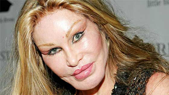 أموال طائلة أنفقها هؤلاء النجوم والمشاهير على عمليات التجميل صورة رقم 10 أموال طائلة أنفقها هؤلاء النجوم والمشاهير على عمليات التجميل صورة رقم 10