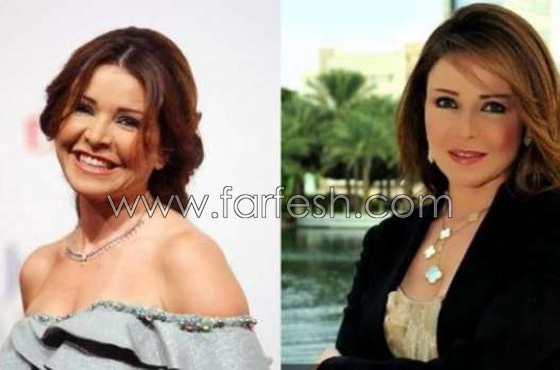  صور قبل وبعد عمليات التجميل لـ 7 مذيعات عربيات: الفرق كبير! صورة رقم 4