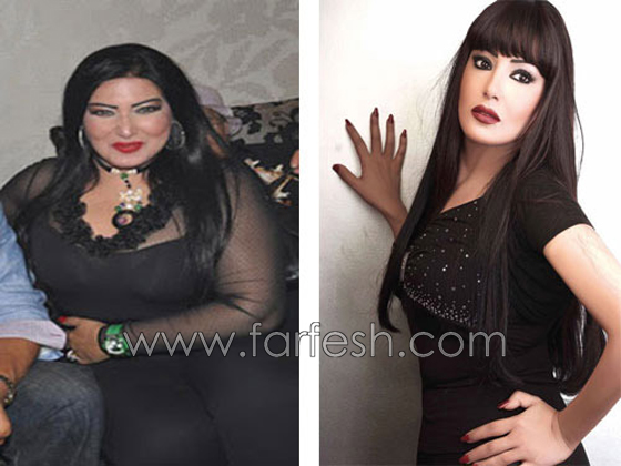 صور فنانين قبل وبعد الدايت: خسروا الوزن الزائد بعد الريجيم صورة رقم 5 صور فنانين قبل وبعد الدايت: خسروا الوزن الزائد بعد الريجيم صورة رقم 5