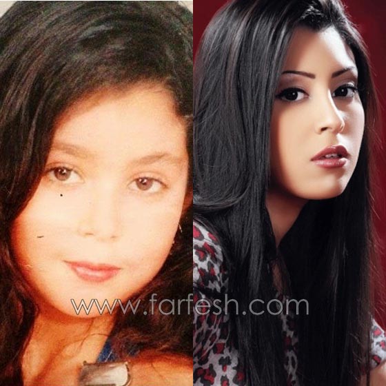 صور فنانين في الطفولة وصورهم الآن.. لن تصدّق الفروق! صورة رقم 10 صور فنانين في الطفولة وصورهم الآن.. لن تصدّق الفروق! صورة رقم 10