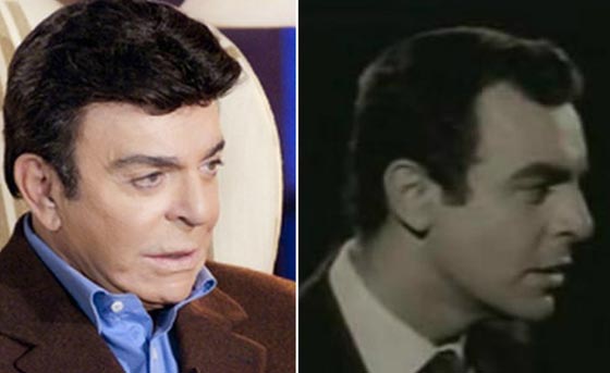 صور نادرة لنجوم عالميين بدون باروكات.. شاهد اشكالهم الحقيقية صورة رقم 1 صور نادرة لنجوم عالميين بدون باروكات.. شاهد اشكالهم الحقيقية صورة رقم 1