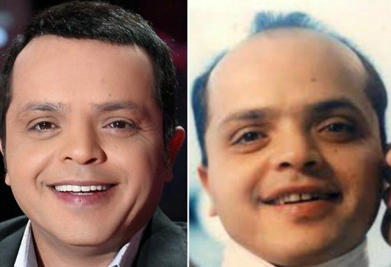 صور نادرة لنجوم عالميين بدون باروكات.. شاهد اشكالهم الحقيقية صورة رقم 11 صور نادرة لنجوم عالميين بدون باروكات.. شاهد اشكالهم الحقيقية صورة رقم 11