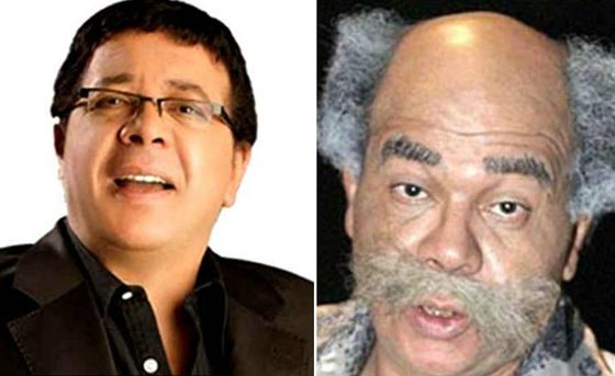 صور نادرة لنجوم عالميين بدون باروكات.. شاهد اشكالهم الحقيقية صورة رقم 14 صور نادرة لنجوم عالميين بدون باروكات.. شاهد اشكالهم الحقيقية صورة رقم 14