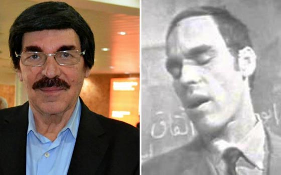 صور نادرة لنجوم عالميين بدون باروكات.. شاهد اشكالهم الحقيقية صورة رقم 18 صور نادرة لنجوم عالميين بدون باروكات.. شاهد اشكالهم الحقيقية صورة رقم 18