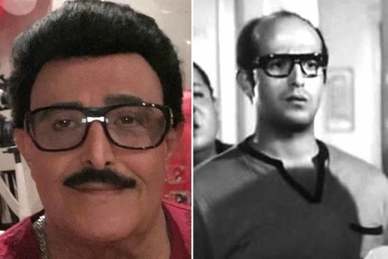 صور نادرة لنجوم عالميين بدون باروكات.. شاهد اشكالهم الحقيقية صورة رقم 19 صور نادرة لنجوم عالميين بدون باروكات.. شاهد اشكالهم الحقيقية صورة رقم 19