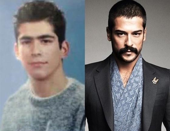 شاهد التحول الذي طرأ على نجوم الدراما التركية قبل وبعد الشهرة.. صور صورة رقم 3 شاهد التحول الذي طرأ على نجوم الدراما التركية قبل وبعد الشهرة.. صور صورة رقم 3