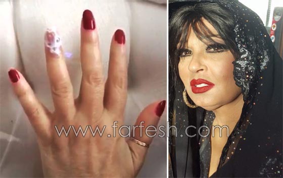 صور فنانين سخر منهم الجمهور لأنهم هوّلوا امراضهم البسيطة! صورة رقم 1 صور فنانين سخر منهم الجمهور لأنهم هوّلوا امراضهم البسيطة! صورة رقم 1