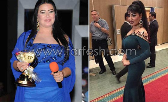 صور فنانين سخر منهم الجمهور لأنهم هوّلوا امراضهم البسيطة! صورة رقم 8 صور فنانين سخر منهم الجمهور لأنهم هوّلوا امراضهم البسيطة! صورة رقم 8