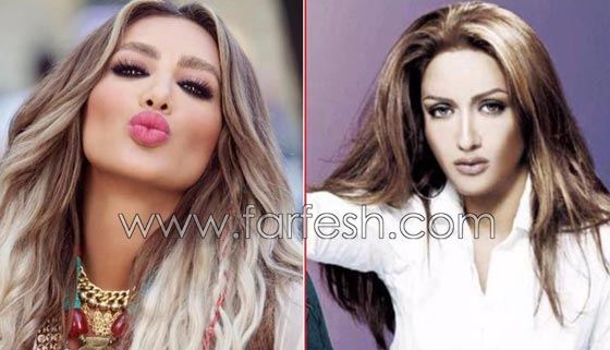 المبالغة في نفخ الشفاه لدى نجمات لبنان.. هل يزيدهن جمالا وتألقا؟! صورة رقم 1 المبالغة في نفخ الشفاه لدى نجمات لبنان.. هل يزيدهن جمالا وتألقا؟! صورة رقم 1