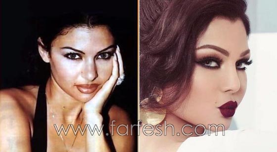 المبالغة في نفخ الشفاه لدى نجمات لبنان.. هل يزيدهن جمالا وتألقا؟! صورة رقم 2 المبالغة في نفخ الشفاه لدى نجمات لبنان.. هل يزيدهن جمالا وتألقا؟! صورة رقم 2