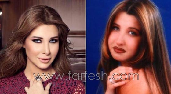 المبالغة في نفخ الشفاه لدى نجمات لبنان.. هل يزيدهن جمالا وتألقا؟! صورة رقم 3 المبالغة في نفخ الشفاه لدى نجمات لبنان.. هل يزيدهن جمالا وتألقا؟! صورة رقم 3