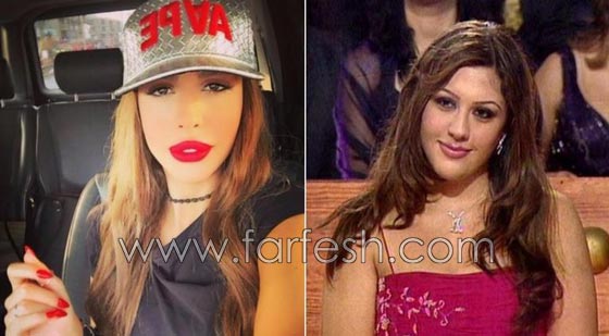 المبالغة في نفخ الشفاه لدى نجمات لبنان.. هل يزيدهن جمالا وتألقا؟! صورة رقم 4 المبالغة في نفخ الشفاه لدى نجمات لبنان.. هل يزيدهن جمالا وتألقا؟! صورة رقم 4