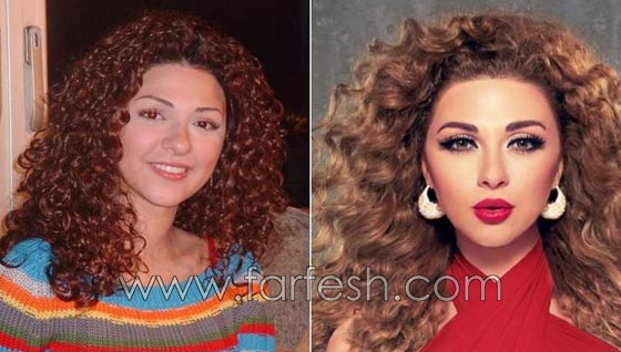المبالغة في نفخ الشفاه لدى نجمات لبنان.. هل يزيدهن جمالا وتألقا؟! صورة رقم 5 المبالغة في نفخ الشفاه لدى نجمات لبنان.. هل يزيدهن جمالا وتألقا؟! صورة رقم 5