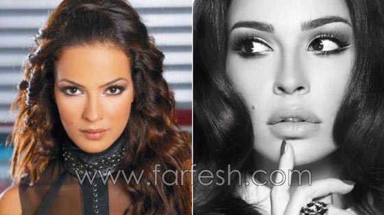 المبالغة في نفخ الشفاه لدى نجمات لبنان.. هل يزيدهن جمالا وتألقا؟! صورة رقم 6 المبالغة في نفخ الشفاه لدى نجمات لبنان.. هل يزيدهن جمالا وتألقا؟! صورة رقم 6