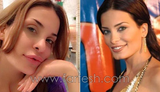 المبالغة في نفخ الشفاه لدى نجمات لبنان.. هل يزيدهن جمالا وتألقا؟! صورة رقم 7 المبالغة في نفخ الشفاه لدى نجمات لبنان.. هل يزيدهن جمالا وتألقا؟! صورة رقم 7