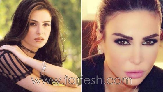 المبالغة في نفخ الشفاه لدى نجمات لبنان.. هل يزيدهن جمالا وتألقا؟! صورة رقم 9 المبالغة في نفخ الشفاه لدى نجمات لبنان.. هل يزيدهن جمالا وتألقا؟! صورة رقم 9
