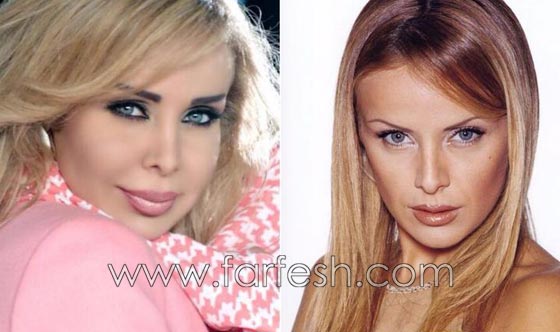المبالغة في نفخ الشفاه لدى نجمات لبنان.. هل يزيدهن جمالا وتألقا؟! صورة رقم 10 المبالغة في نفخ الشفاه لدى نجمات لبنان.. هل يزيدهن جمالا وتألقا؟! صورة رقم 10