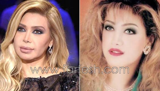 المبالغة في نفخ الشفاه لدى نجمات لبنان.. هل يزيدهن جمالا وتألقا؟! صورة رقم 12 المبالغة في نفخ الشفاه لدى نجمات لبنان.. هل يزيدهن جمالا وتألقا؟! صورة رقم 12