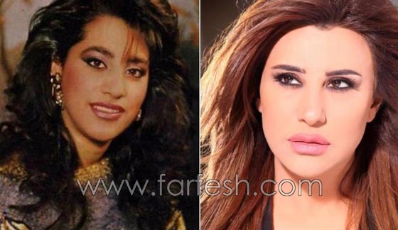 المبالغة في نفخ الشفاه لدى نجمات لبنان.. هل يزيدهن جمالا وتألقا؟! صورة رقم 13 المبالغة في نفخ الشفاه لدى نجمات لبنان.. هل يزيدهن جمالا وتألقا؟! صورة رقم 13
