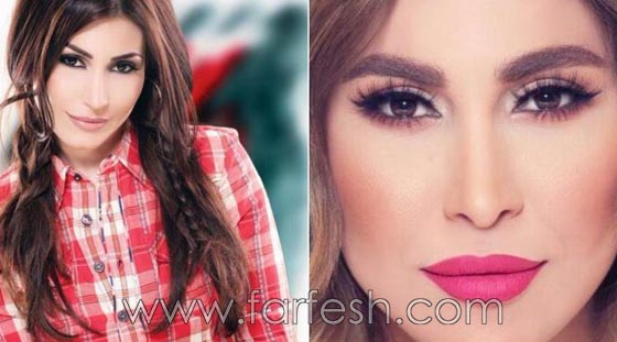 المبالغة في نفخ الشفاه لدى نجمات لبنان.. هل يزيدهن جمالا وتألقا؟! صورة رقم 14 المبالغة في نفخ الشفاه لدى نجمات لبنان.. هل يزيدهن جمالا وتألقا؟! صورة رقم 14