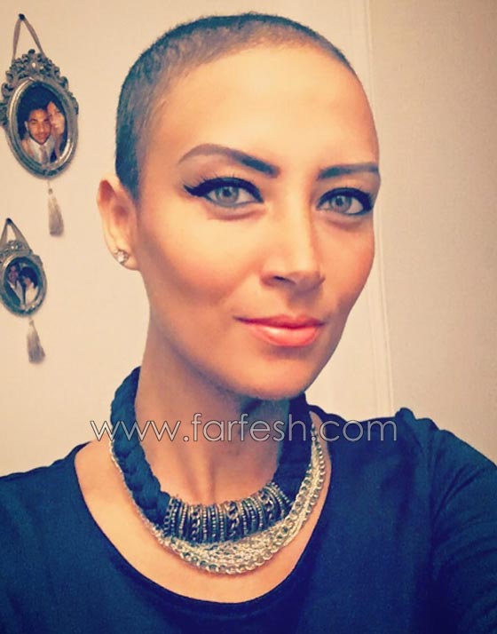 مريضة سرطان حقيقية بطلة جريئة تبهر مشاهدي مسلسل حلاوة الدنيا صورة رقم 3 مريضة سرطان حقيقية بطلة جريئة تبهر مشاهدي مسلسل حلاوة الدنيا صورة رقم 3