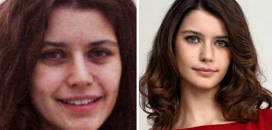 هل تحتمل الصدمة؟! النجمات التركيات مع وبدون مكياج.. صور صورة رقم 10 هل تحتمل الصدمة؟! النجمات التركيات مع وبدون مكياج.. صور صورة رقم 10