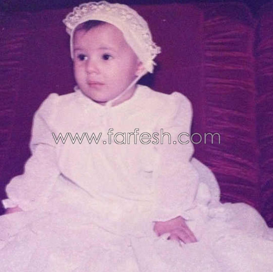 صور وفيديو دنيا سمير غانم أيام الطفولة والمراهقة تكشف اسرار عمليات التجميل صورة رقم 6 صور وفيديو دنيا سمير غانم أيام الطفولة والمراهقة تكشف اسرار عمليات التجميل صورة رقم 6