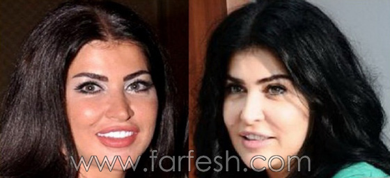 صور جومانا مراد بعد تغير وجهها بسبب عمليات تجميل فاشلة. وما علاقتها بمراد يلدريم؟ صورة رقم 1 صور جومانا مراد بعد تغير وجهها بسبب عمليات تجميل فاشلة. وما علاقتها بمراد يلدريم؟ صورة رقم 1
