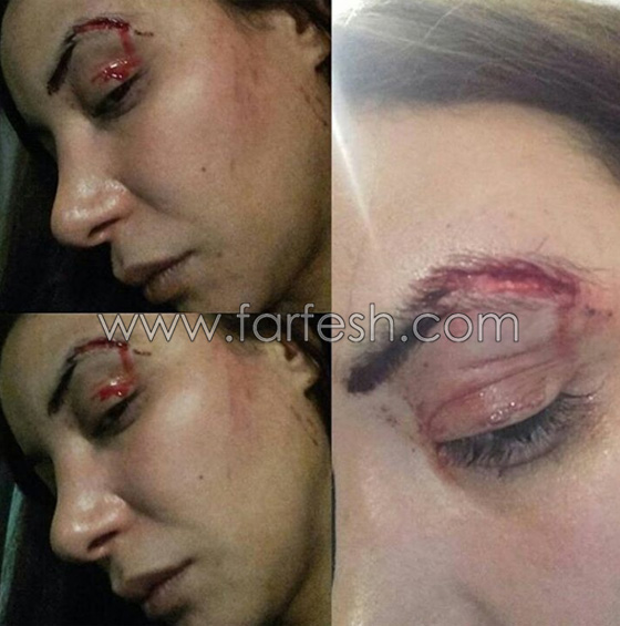 صور: فنانة عربية تودع جمهورها وتكشف اصابتها بالسرطان.. صورة رقم 2 صور: فنانة عربية تودع جمهورها وتكشف اصابتها بالسرطان.. صورة رقم 2