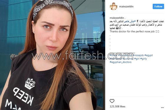 صور مي عز الدين تكشف: أجريت عملية تجميل في أنفي بسبب السيلفي! صورة رقم 1 صور مي عز الدين تكشف: أجريت عملية تجميل في أنفي بسبب السيلفي! صورة رقم 1