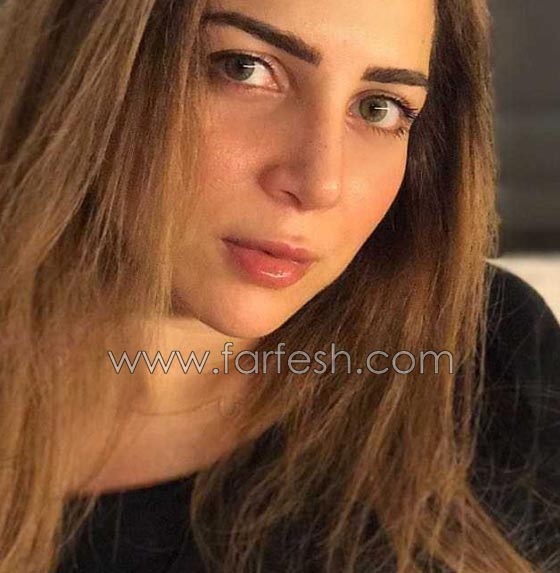 صور مي عز الدين تكشف: أجريت عملية تجميل في أنفي بسبب السيلفي! صورة رقم 3 صور مي عز الدين تكشف: أجريت عملية تجميل في أنفي بسبب السيلفي! صورة رقم 3