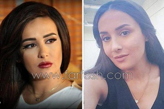 صور فنانات غيّرن ملامح وجوههن بدون عملبات تجميل.. ما هو السر؟ صورة رقم 5 صور فنانات غيّرن ملامح وجوههن بدون عملبات تجميل.. ما هو السر؟ صورة رقم 5