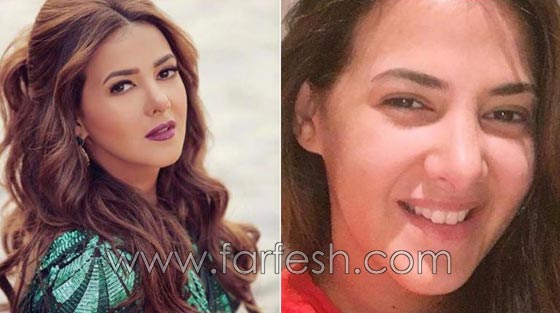 صور فنانات غيّرن ملامح وجوههن بدون عملبات تجميل.. ما هو السر؟ صورة رقم 6 صور فنانات غيّرن ملامح وجوههن بدون عملبات تجميل.. ما هو السر؟ صورة رقم 6