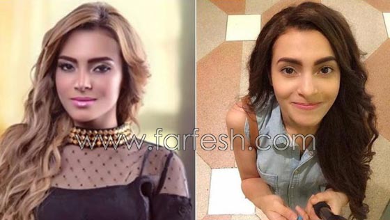 صور فنانات غيّرن ملامح وجوههن بدون عملبات تجميل.. ما هو السر؟ صورة رقم 7 صور فنانات غيّرن ملامح وجوههن بدون عملبات تجميل.. ما هو السر؟ صورة رقم 7