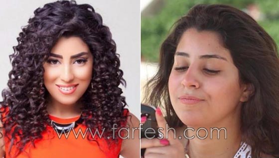 صور فنانات غيّرن ملامح وجوههن بدون عملبات تجميل.. ما هو السر؟ صورة رقم 11 صور فنانات غيّرن ملامح وجوههن بدون عملبات تجميل.. ما هو السر؟ صورة رقم 11