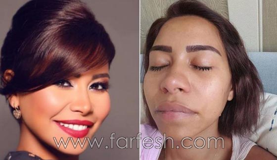 صور فنانات غيّرن ملامح وجوههن بدون عملبات تجميل.. ما هو السر؟ صورة رقم 3 صور فنانات غيّرن ملامح وجوههن بدون عملبات تجميل.. ما هو السر؟ صورة رقم 3